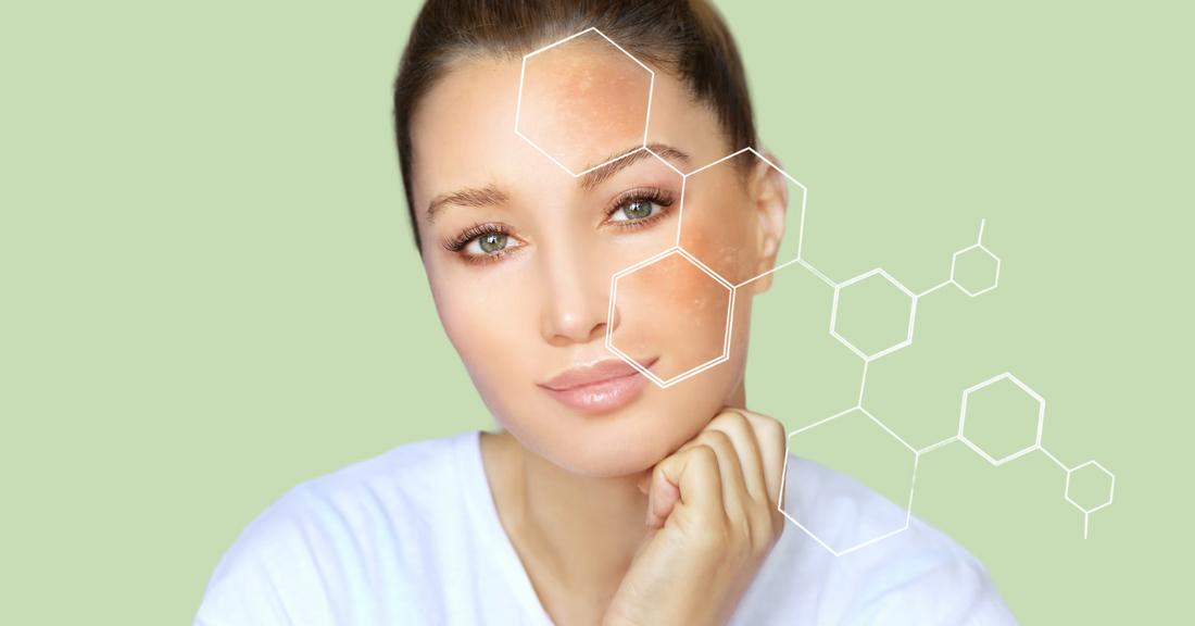 Sensitive Skin, Allergic Reactions & Skin Purging